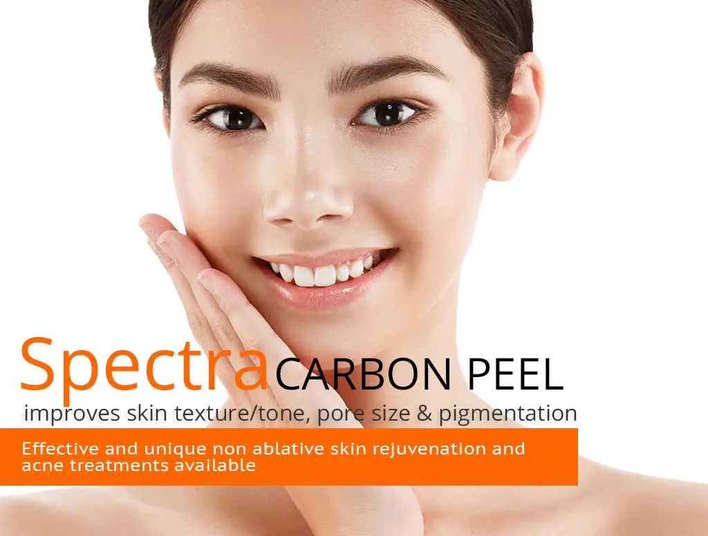 spectra-carbon-peel-for-acne