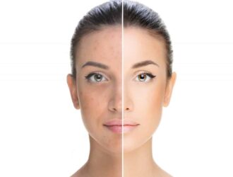 tan removal remedies