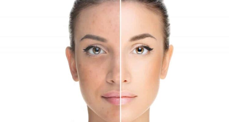 tan removal remedies