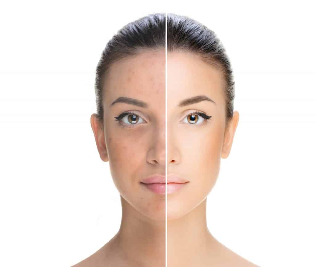tan removal remedies