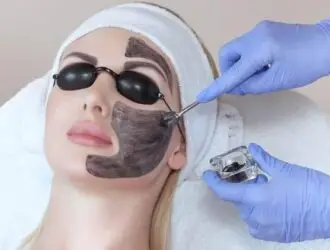 Carbon Peel Treatment