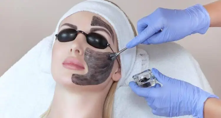 Carbon Peel Treatment