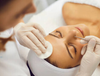 Whiteheads Causes and Prevention