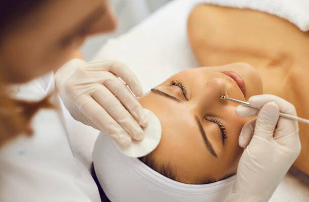 Whiteheads Causes and Prevention